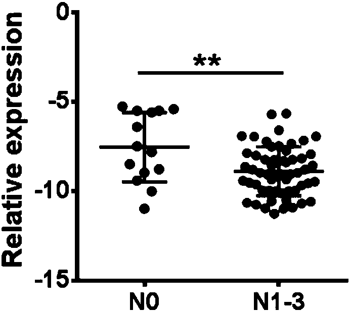 Application of lncRNA SGOL1-AS1 serving as marker for diagnosing stomach cancer