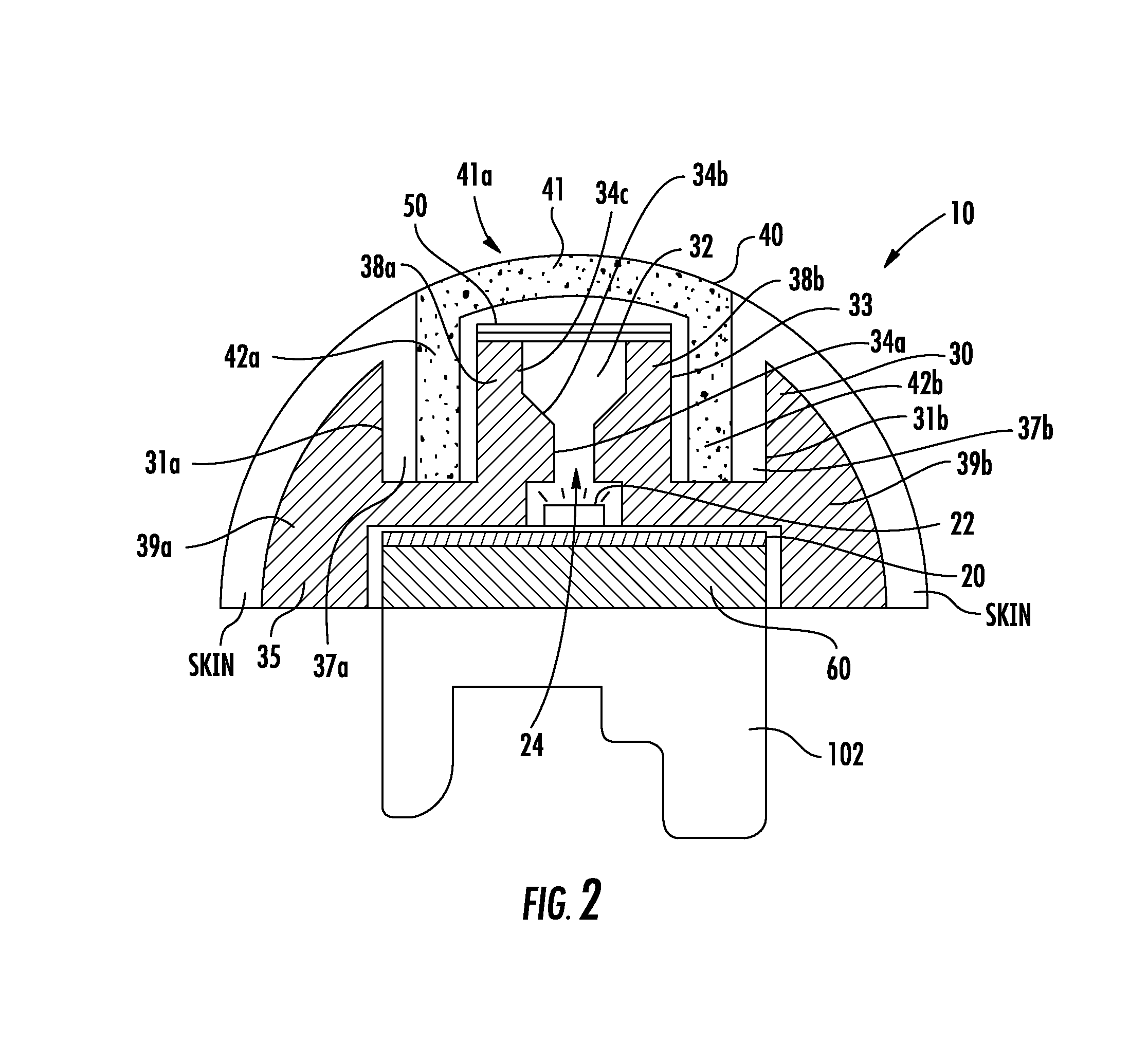 Steering grip light bar systems