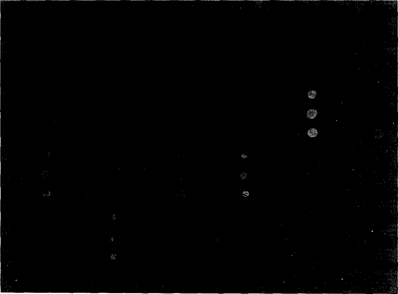 DNA chip for diagnosing phenylketonuria