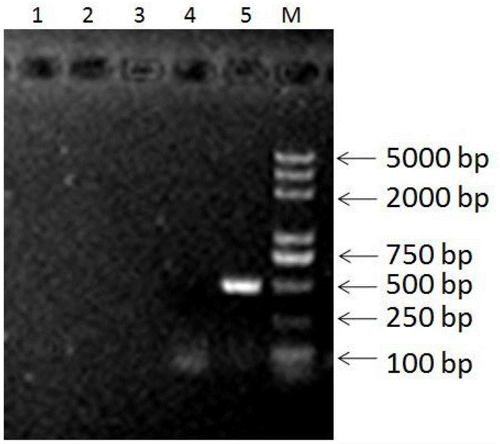 Primer pair for detecting pigeon torque teno viruses and application of primer pair