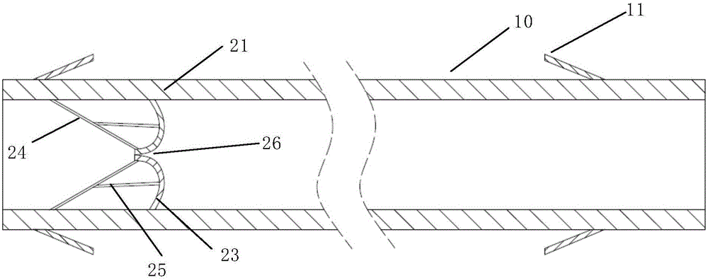 Anti-backflow biliary tract drainage support