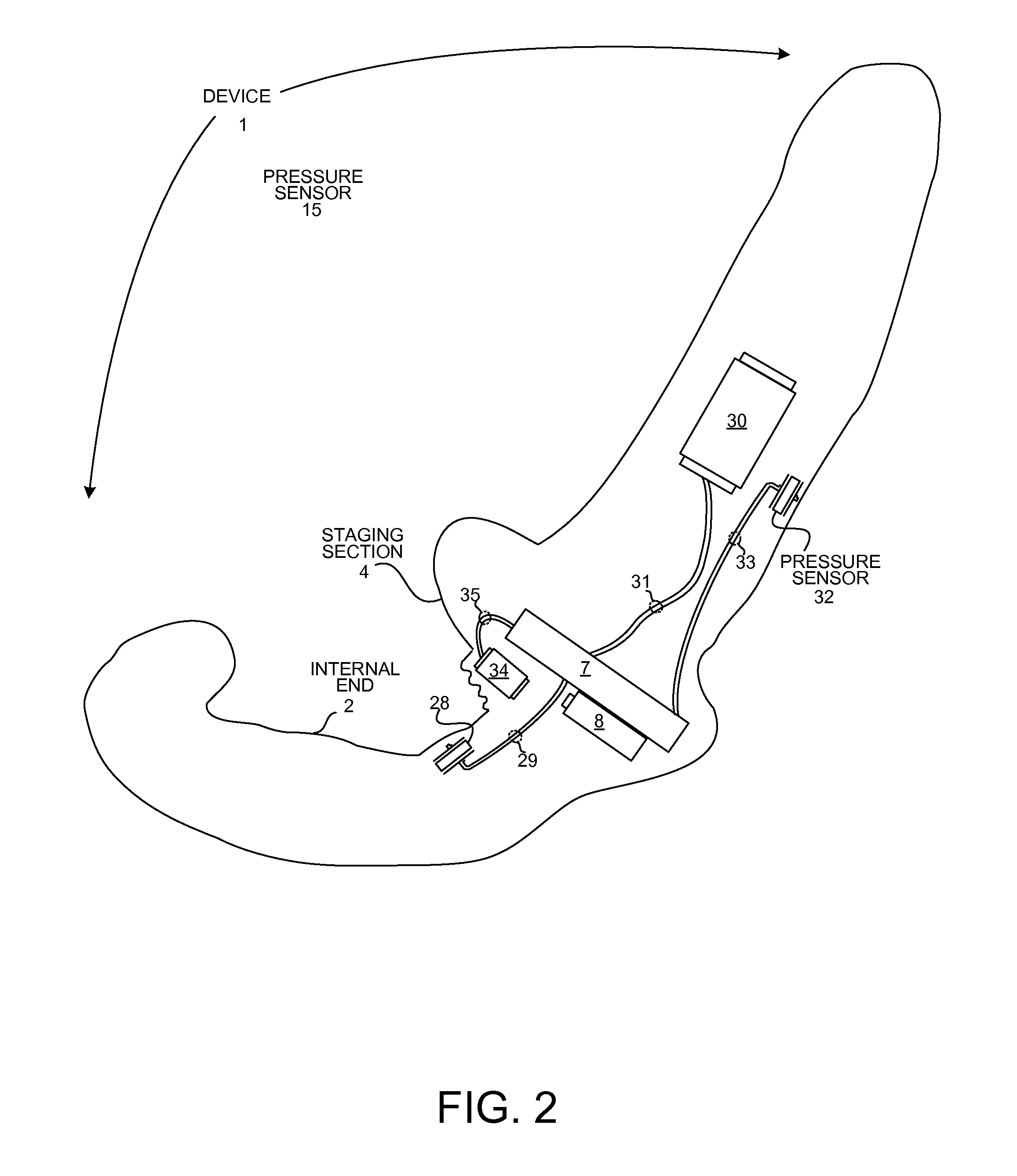 Cybernetic vibrator device with sensors for in-situ gesture controls