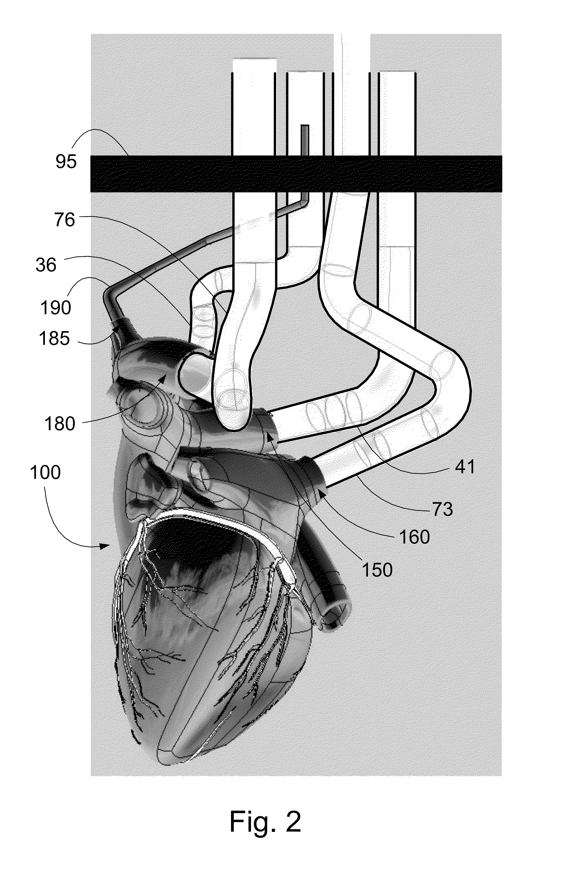 Apparatus for testing, assessment, and maintenance of harvested hearts for transplanting