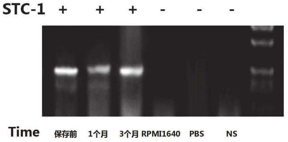 Nucleic acid sample preserving fluid as well as preparation method and application thereof