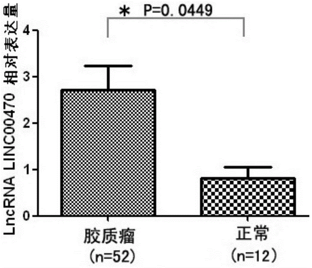 Application method of serum Exosomes derived long no-coding RNA LINC00470