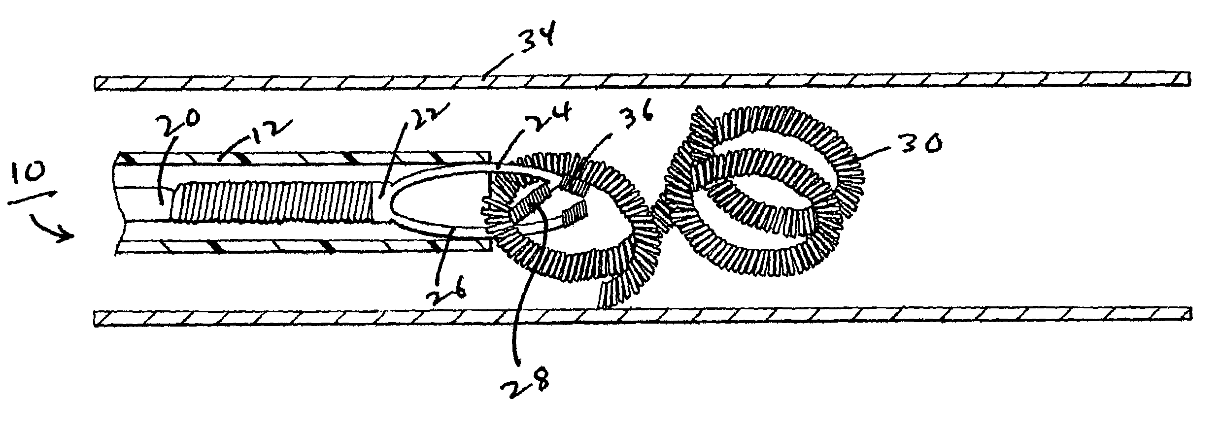 Method and device for retrieving embolic coils