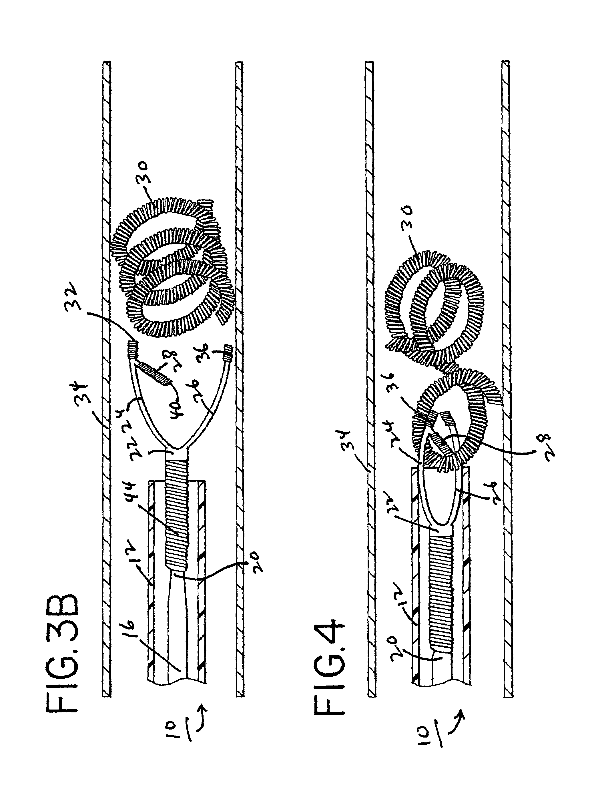 Method and device for retrieving embolic coils