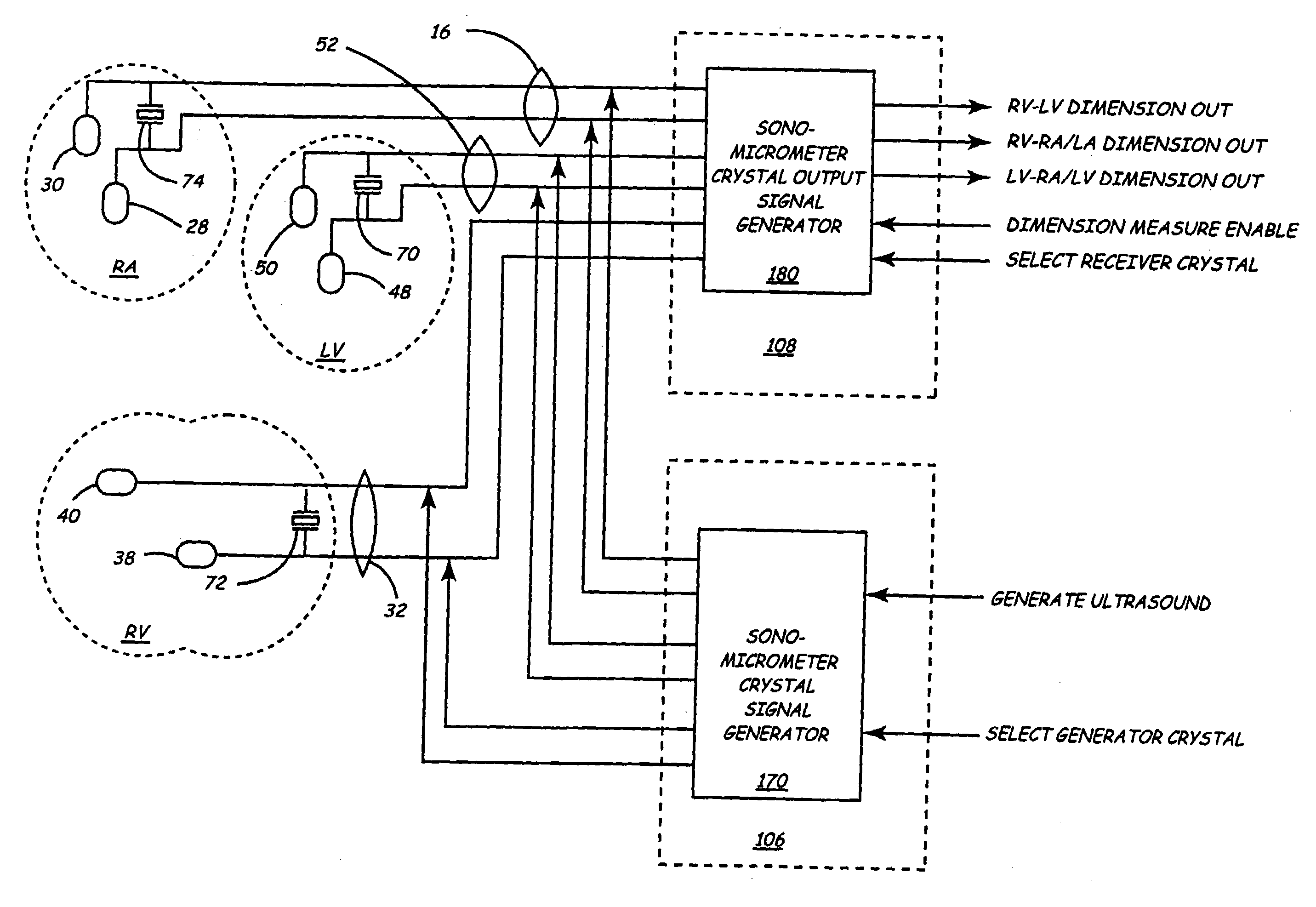 Implantable medical device employing sonomicrometer output signals for detection and measurement of cardiac mechanical function