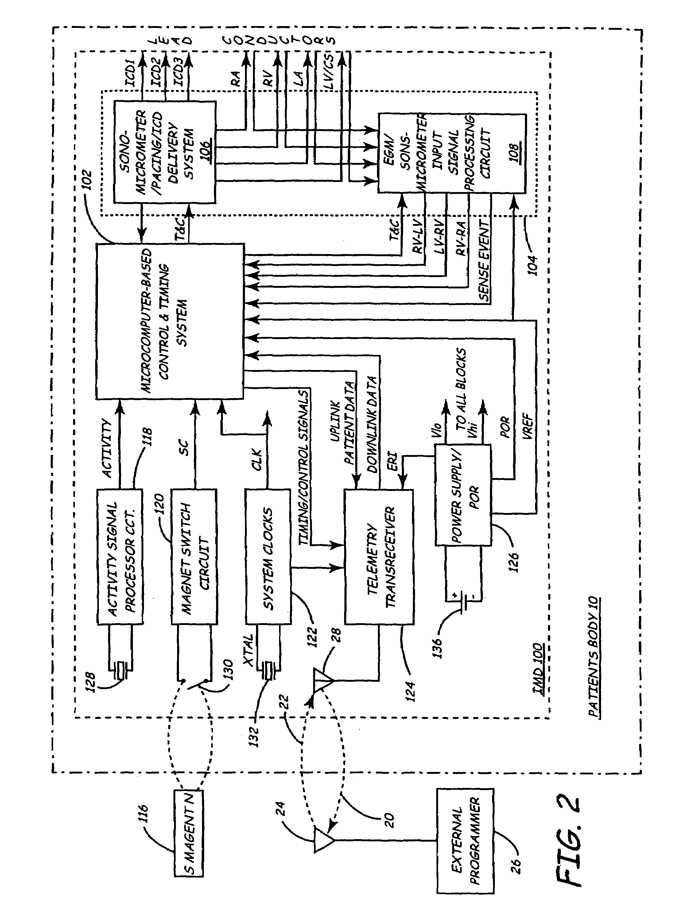 Implantable medical device employing sonomicrometer output signals for detection and measurement of cardiac mechanical function