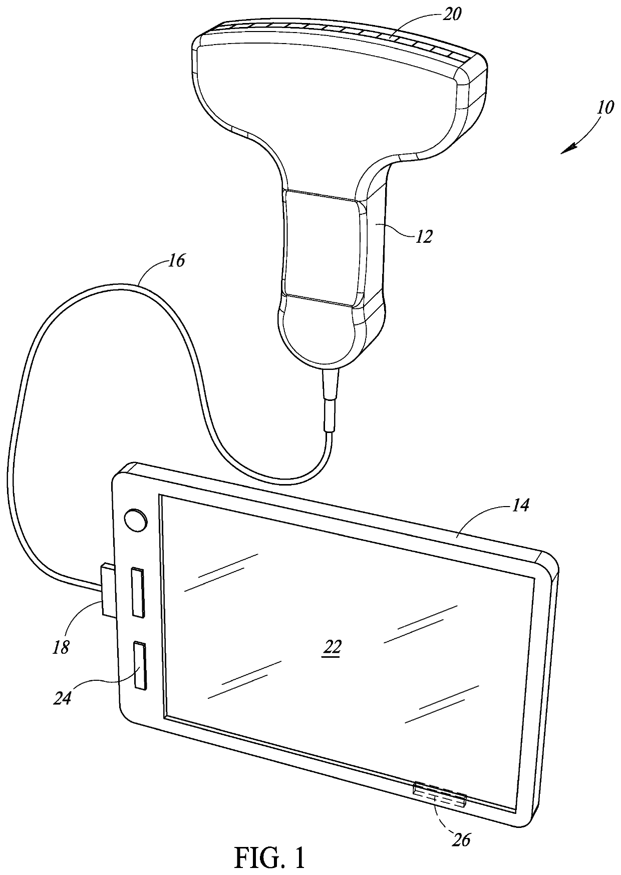 Ultrasound system with docking station and dockable ultrasound probe