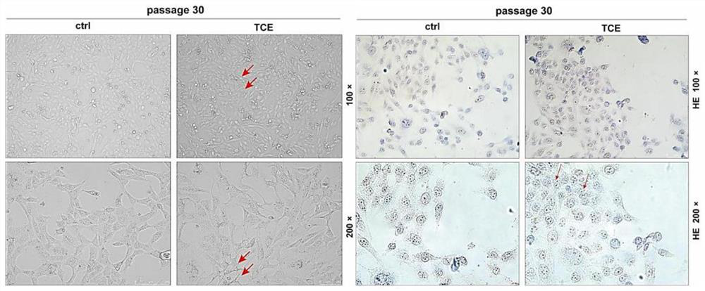 Method for inducing vicious transformation of human hepatocytes by trichloroethylene and application of method