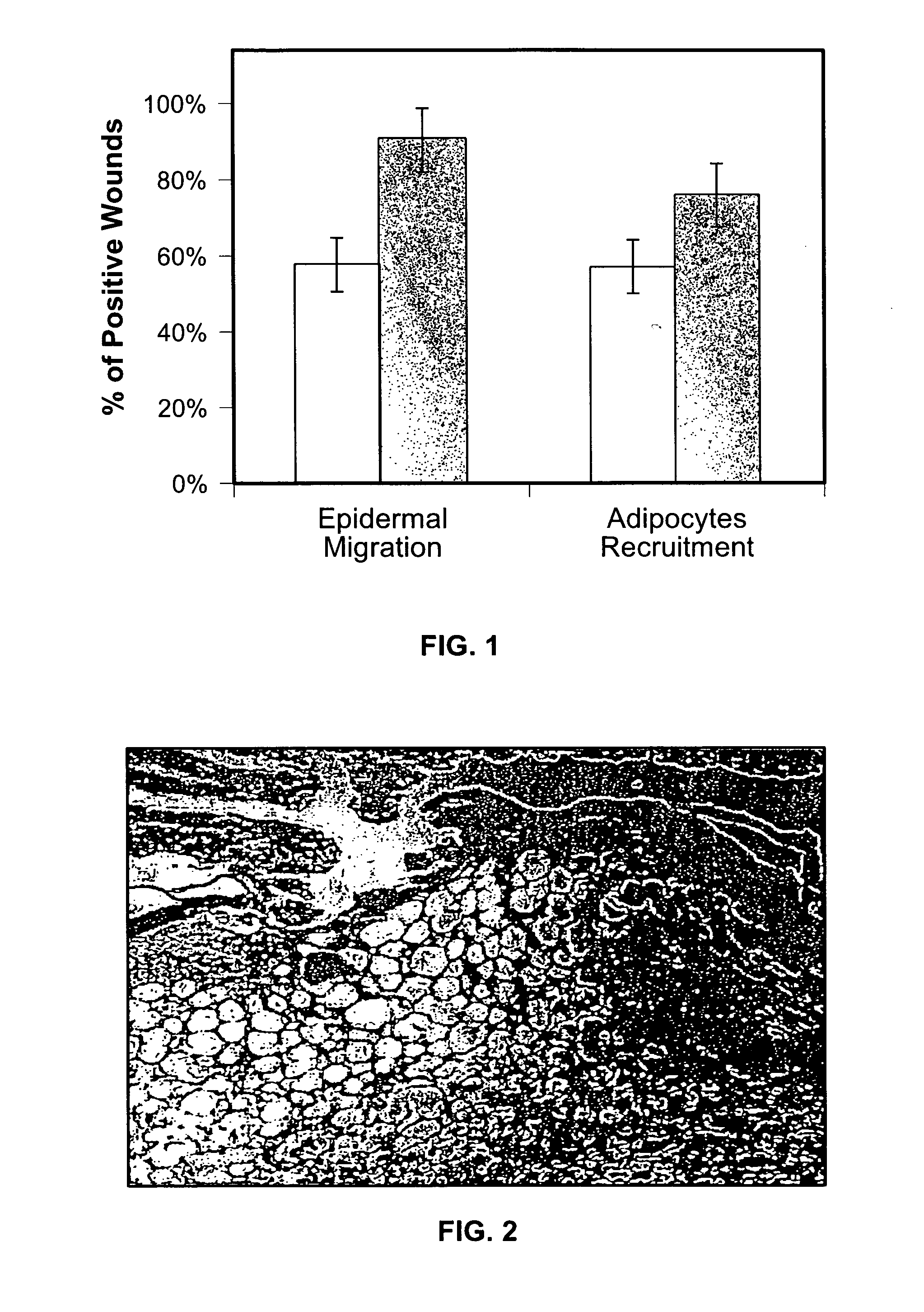 Methods for accelerating wound healing by administration of adipokines