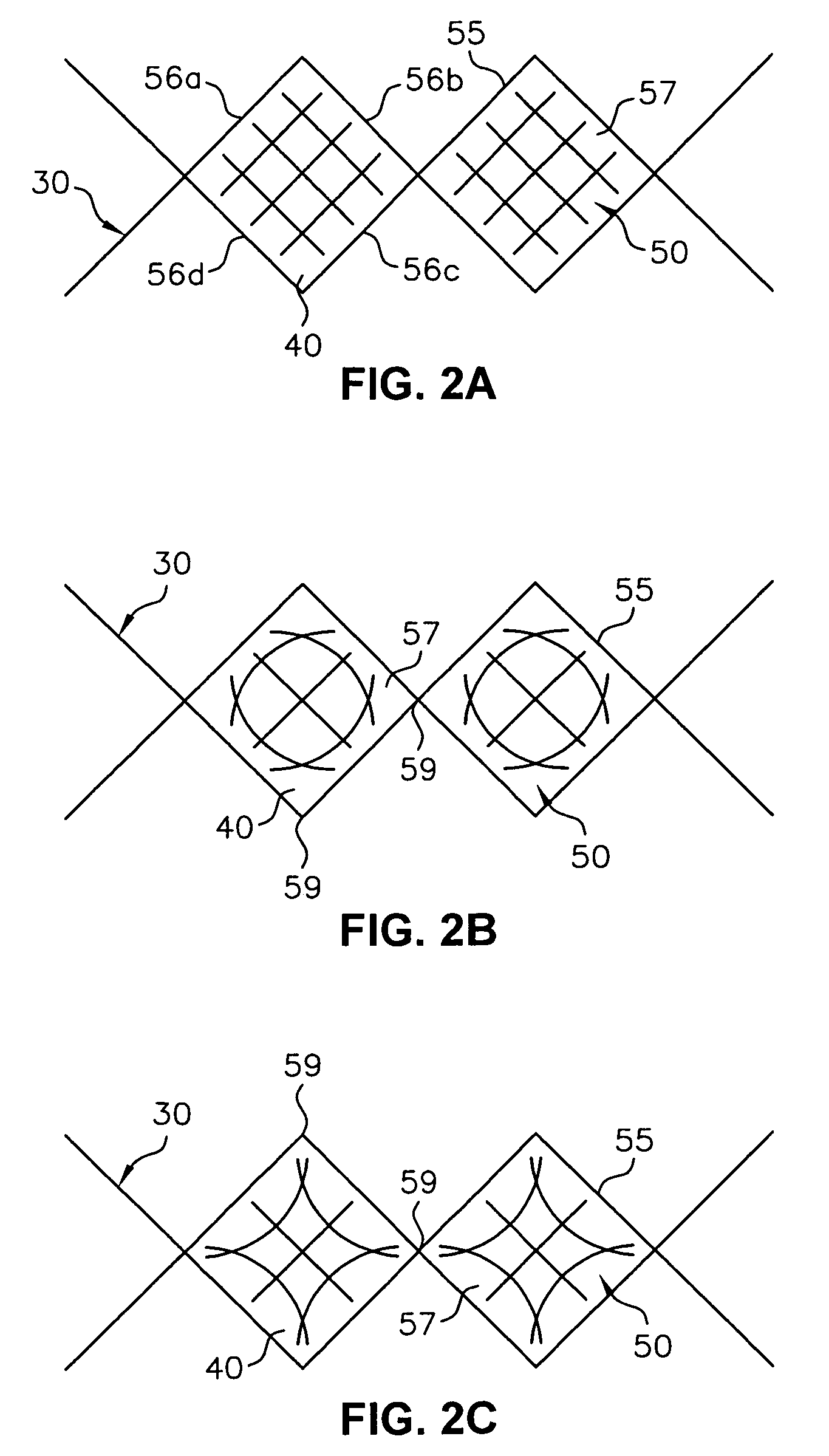 Endoluminal device and system and method for detecting a change in pressure differential across an endoluminal device