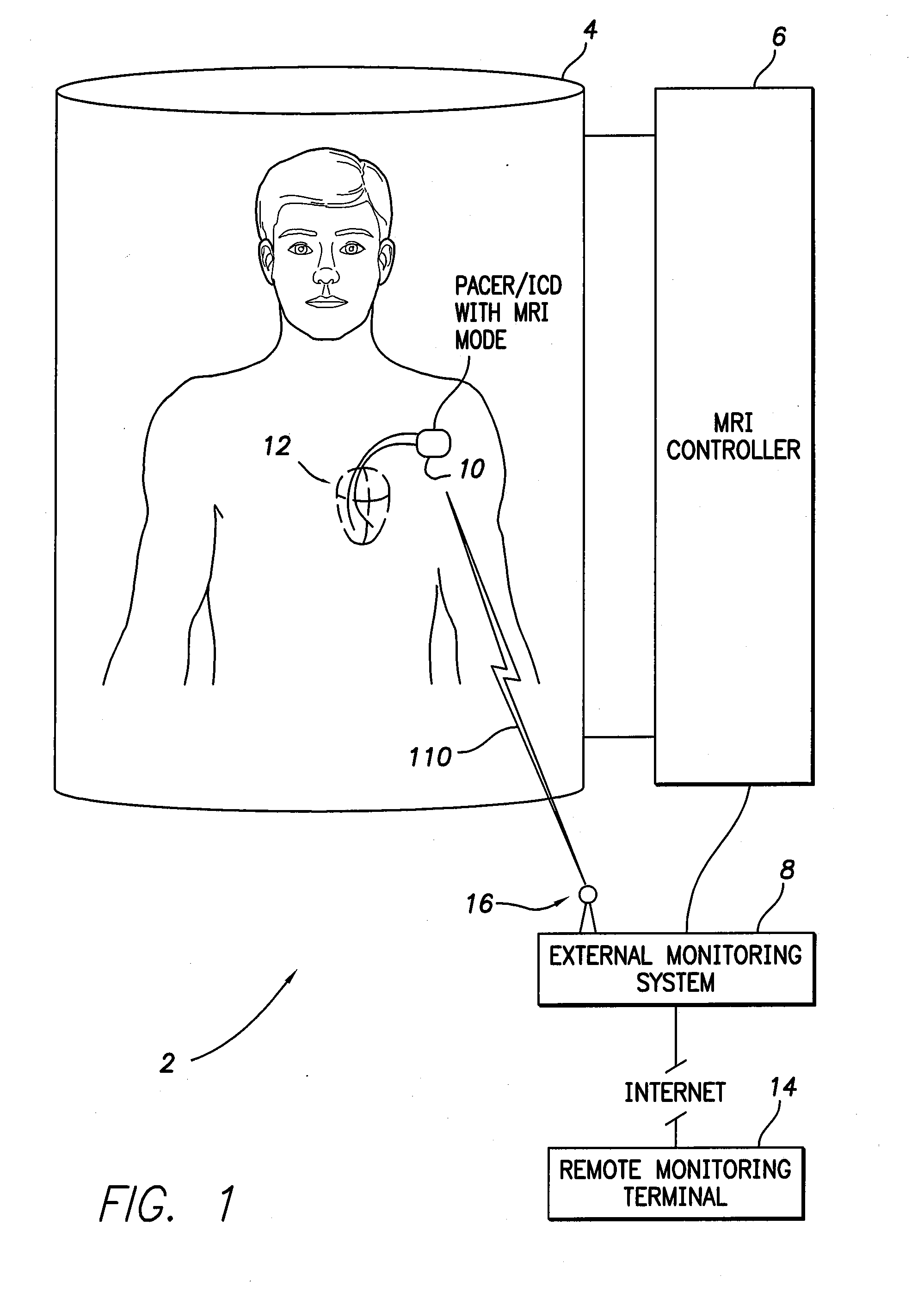 Systems and methods for remote monitoring of signals sensed by an implantable medical device during an MRI