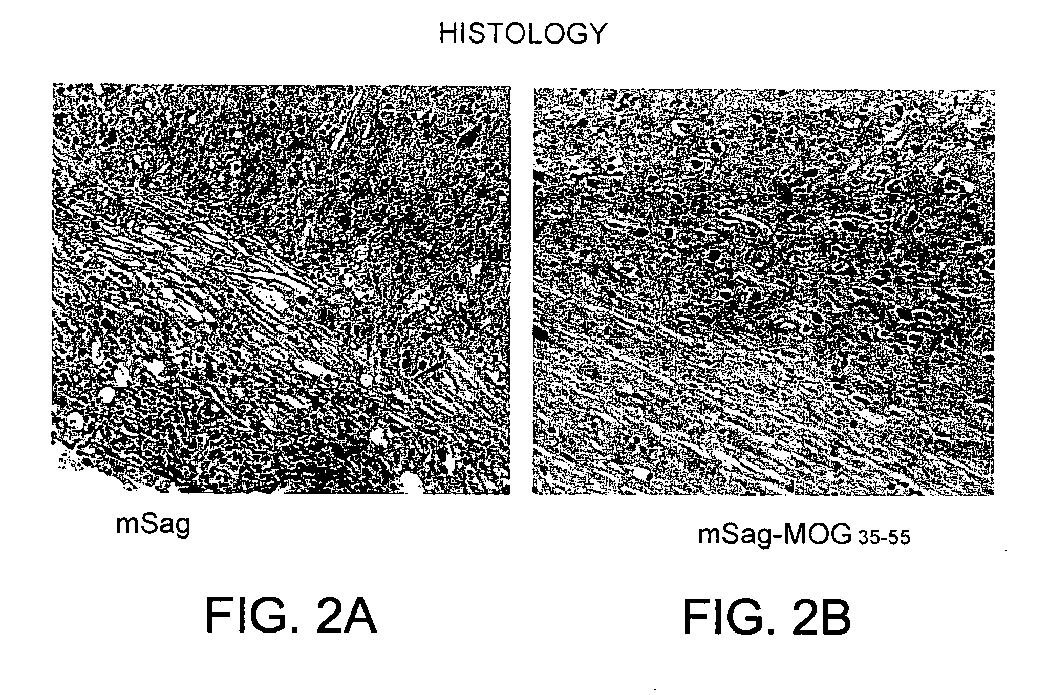 Superantigen conjugate