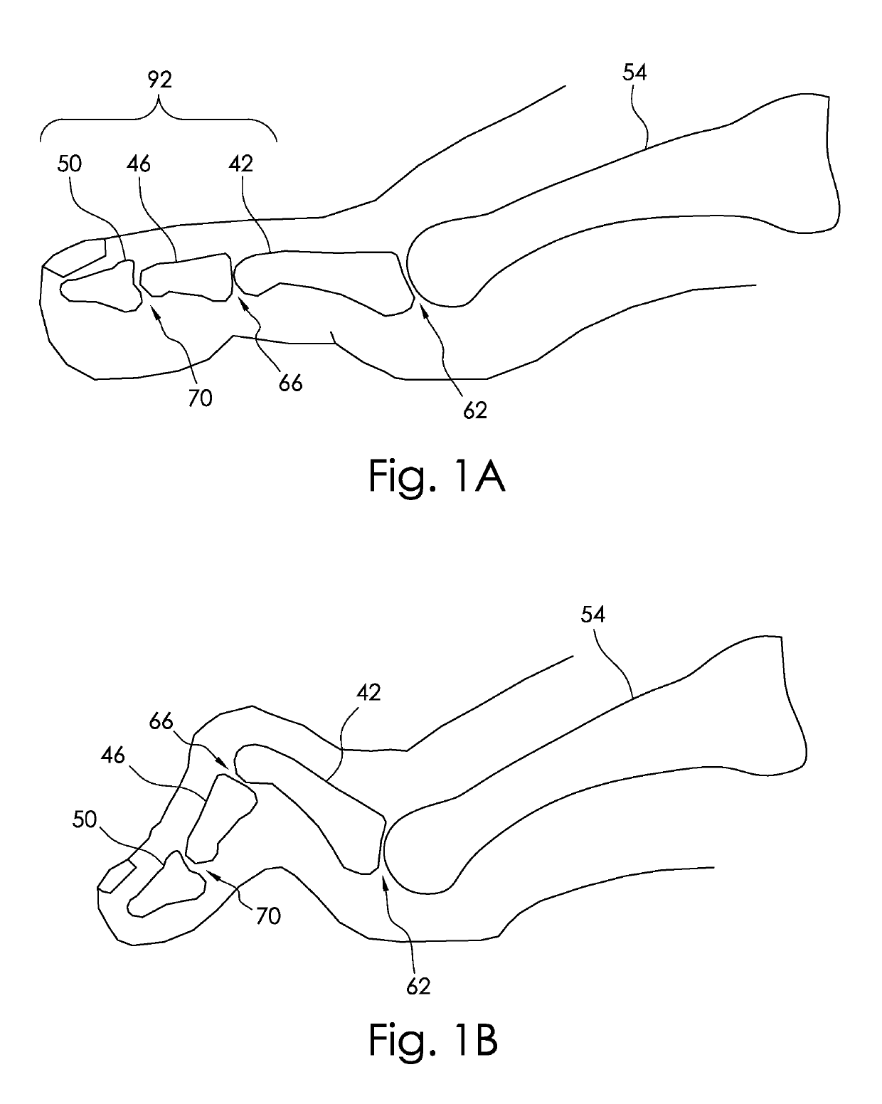 Fasteners with shape changing zigzag structures and methods using same