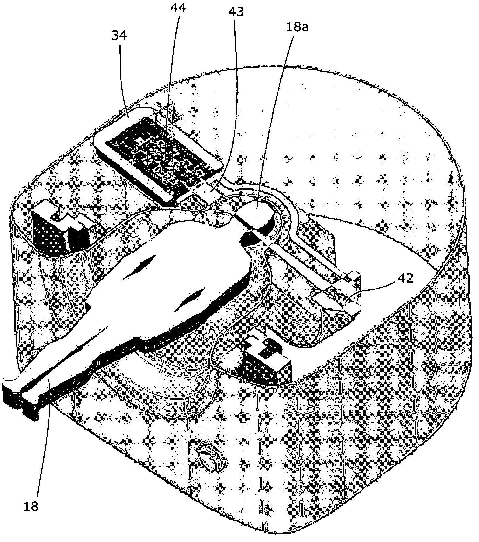 Method and apparatus for treatment by ionizing radiation