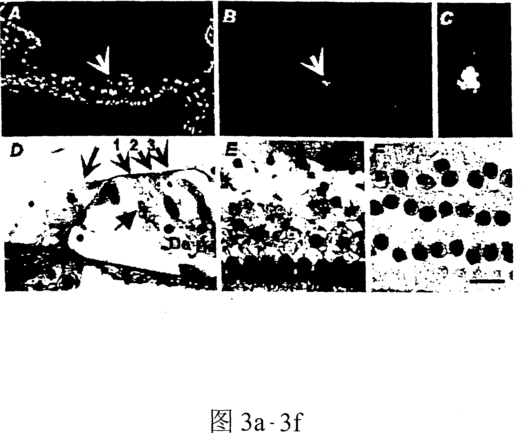 Method for preventing/treating damage to sensory hair cells and cochlear neurons