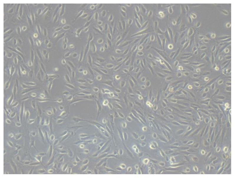 Urine-derived mesenchymal stem cell mitochondria as well as transplanting method and application thereof