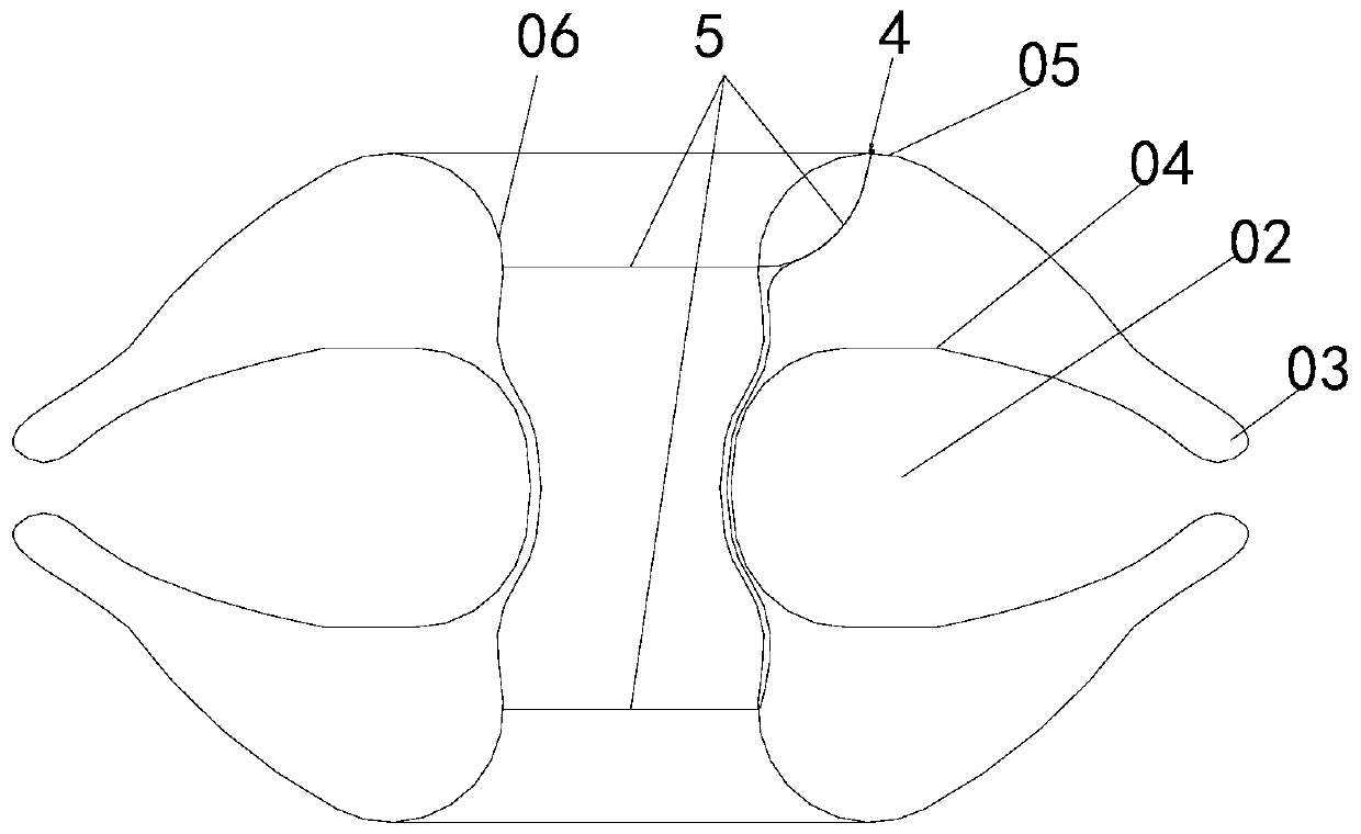 A highly stable and adaptively adjustable atrial shunt device