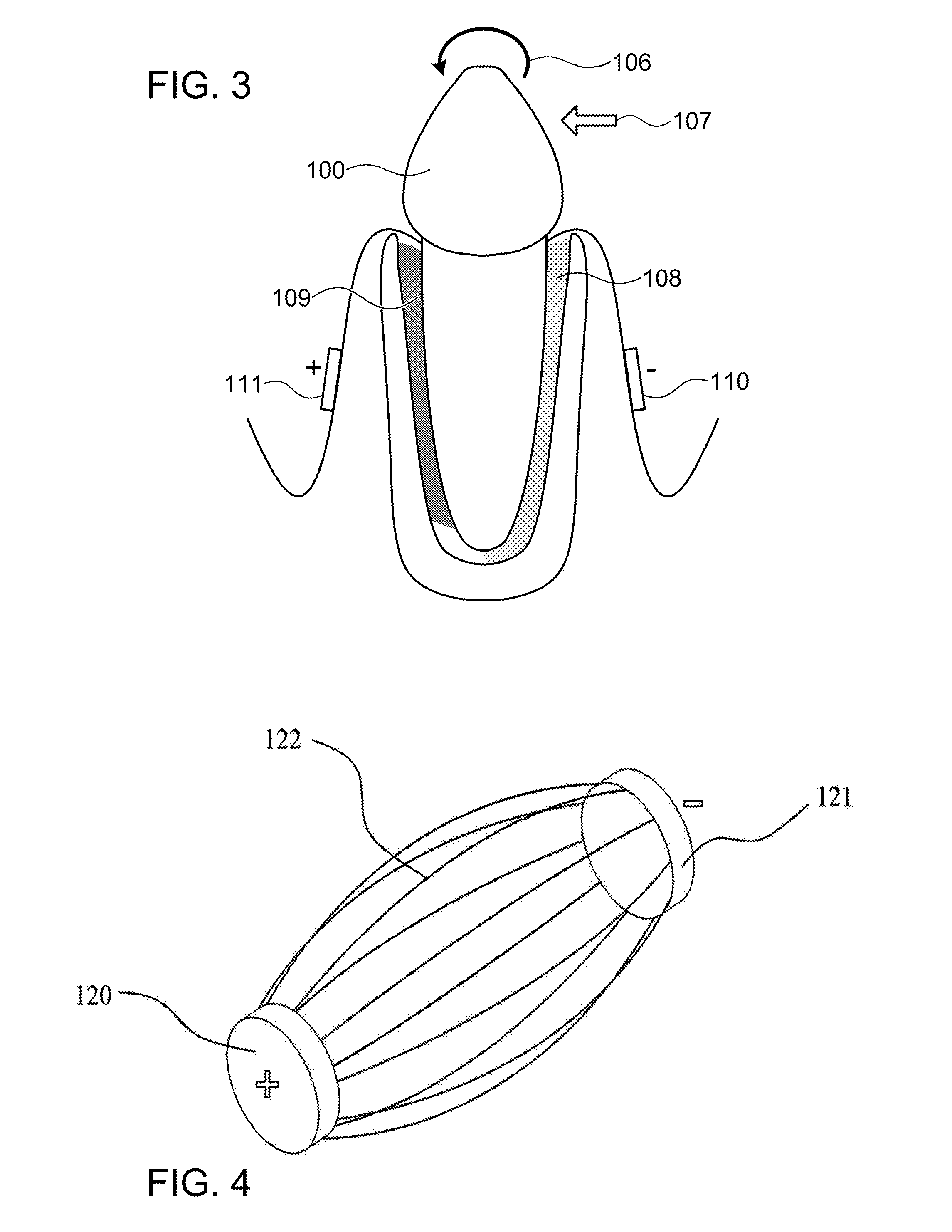 Method to enhance orthodontic tooth movement