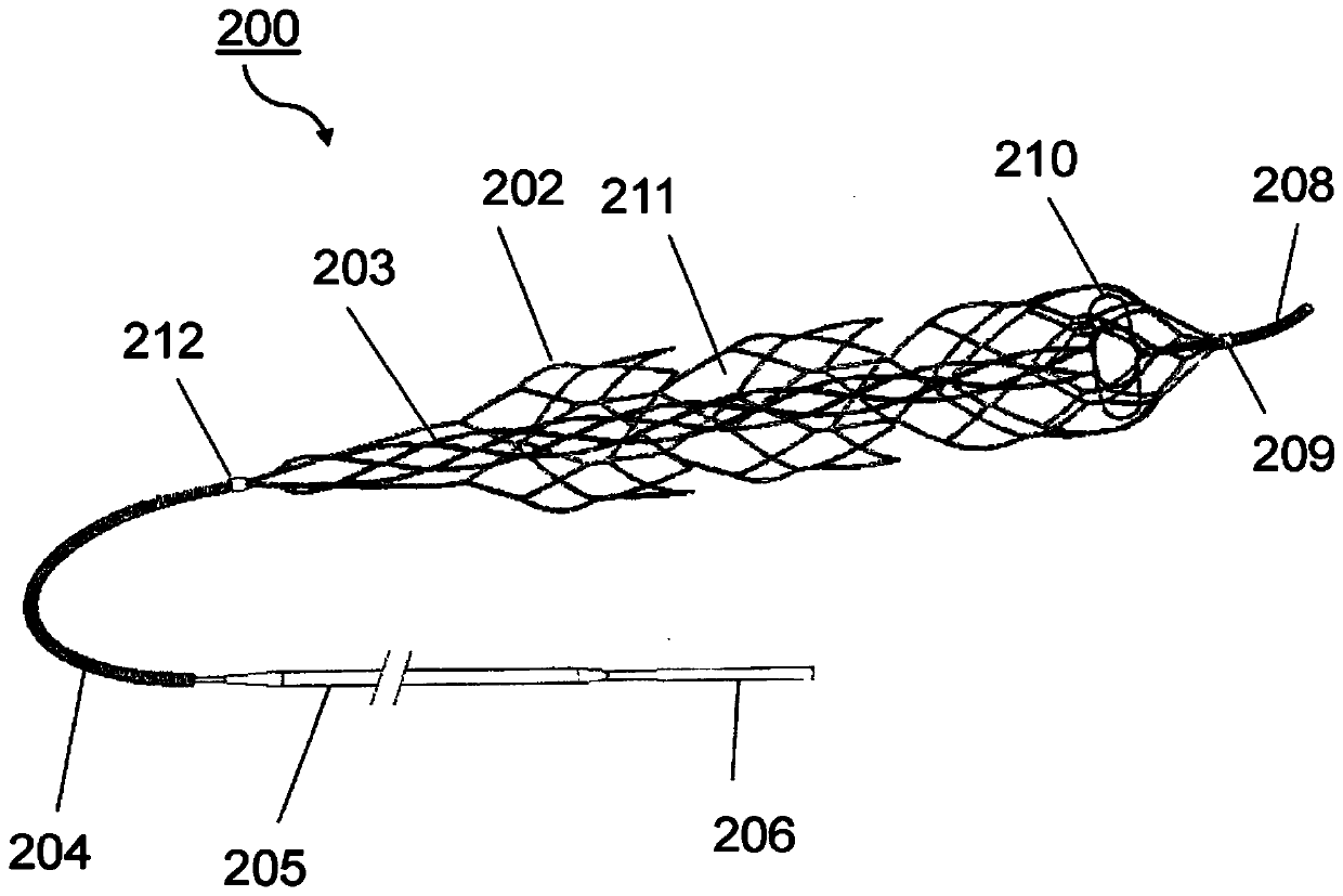 Method and apparatus for managing acute ischemic event