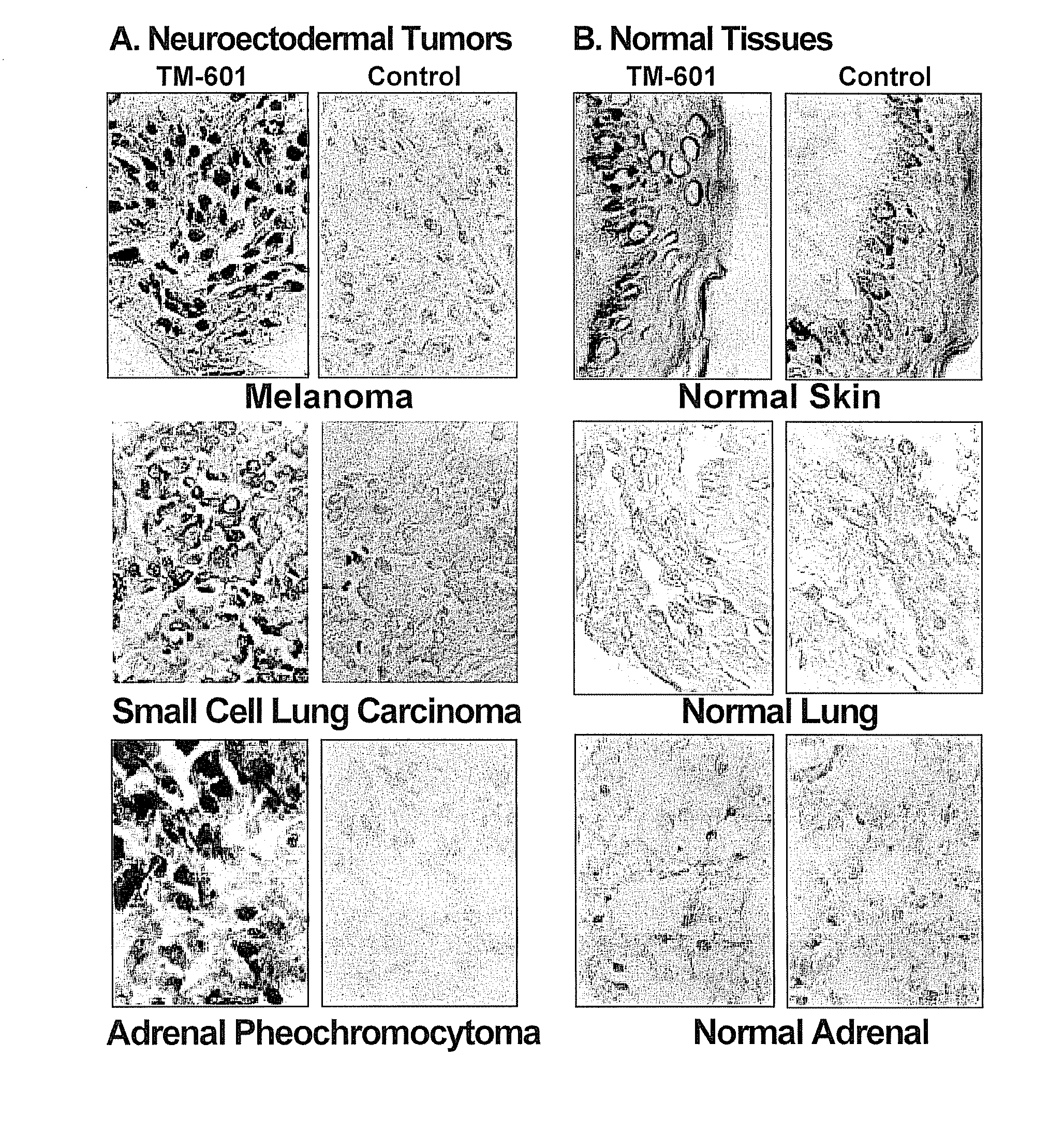 Systemic Administration of Chlorotoxin Agents for the Diagnosis and Treatment of Tumors