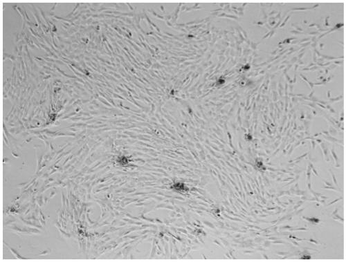 Method for preparing amniotic mesenchymal stem cells from human placental amniotic membrane and its application