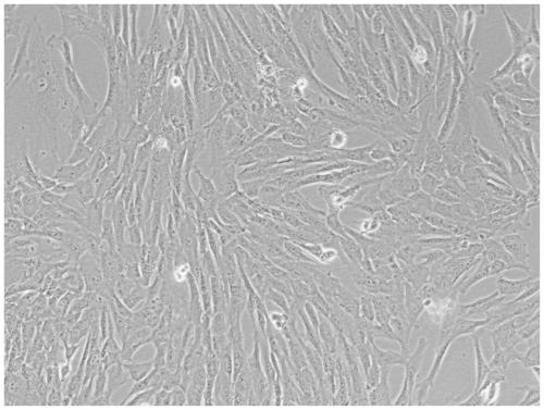 Method for preparing amniotic mesenchymal stem cells from human placental amniotic membrane and its application