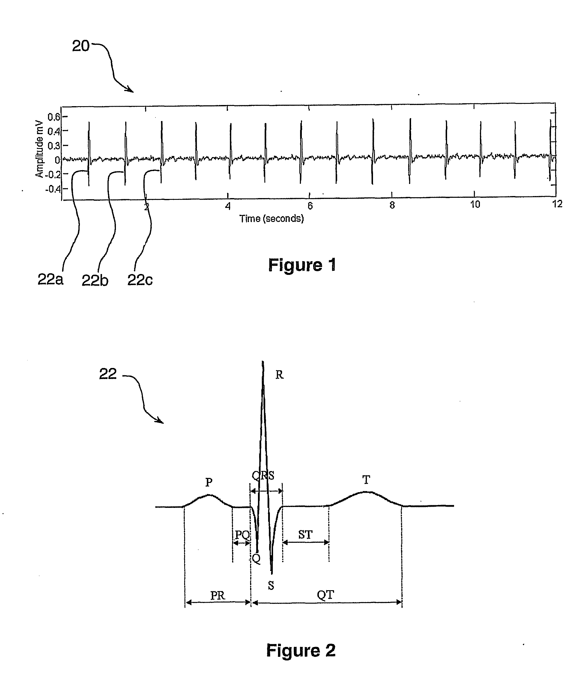 Apparatus for Monitoring Fetal Heart-Beat