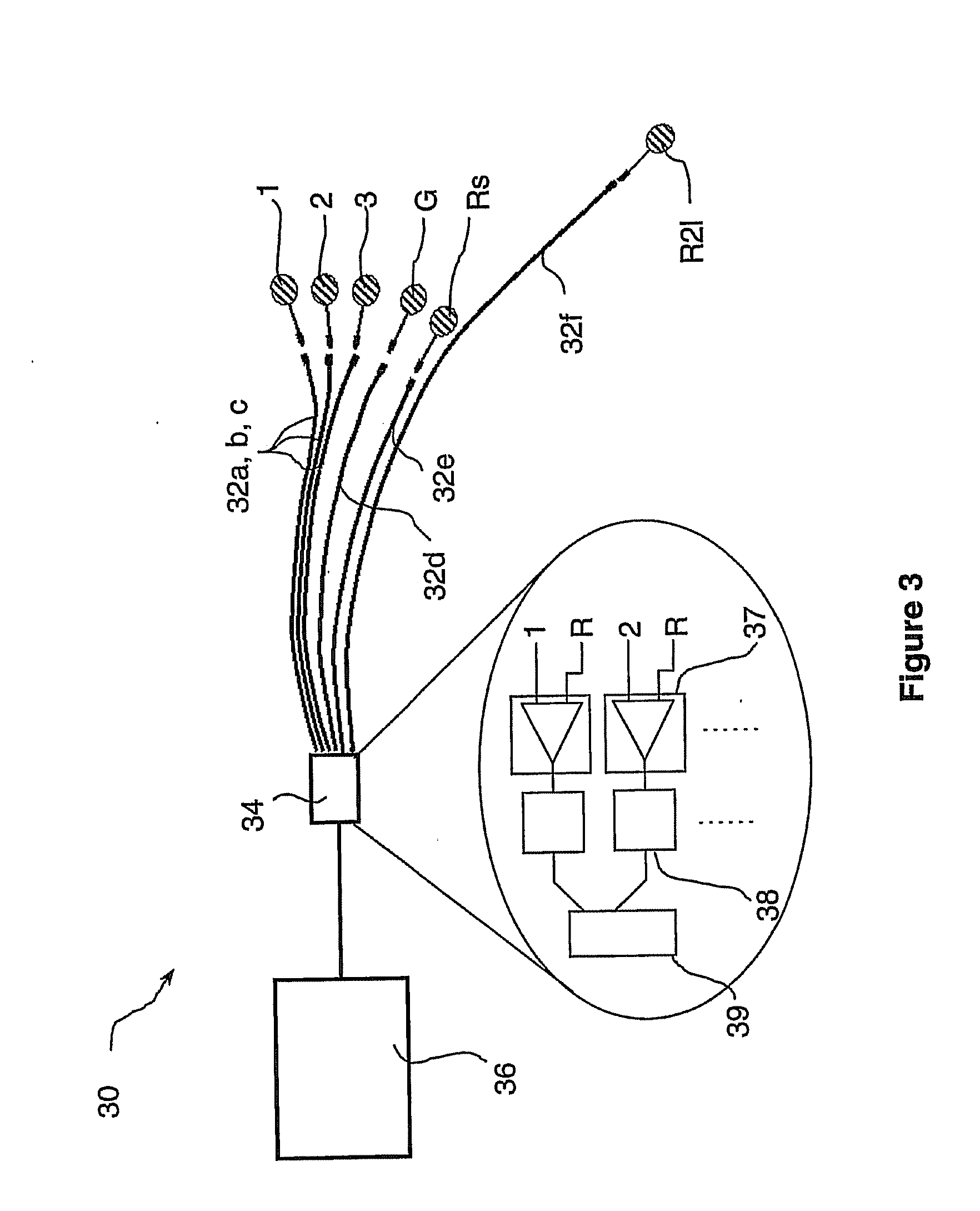 Apparatus for Monitoring Fetal Heart-Beat