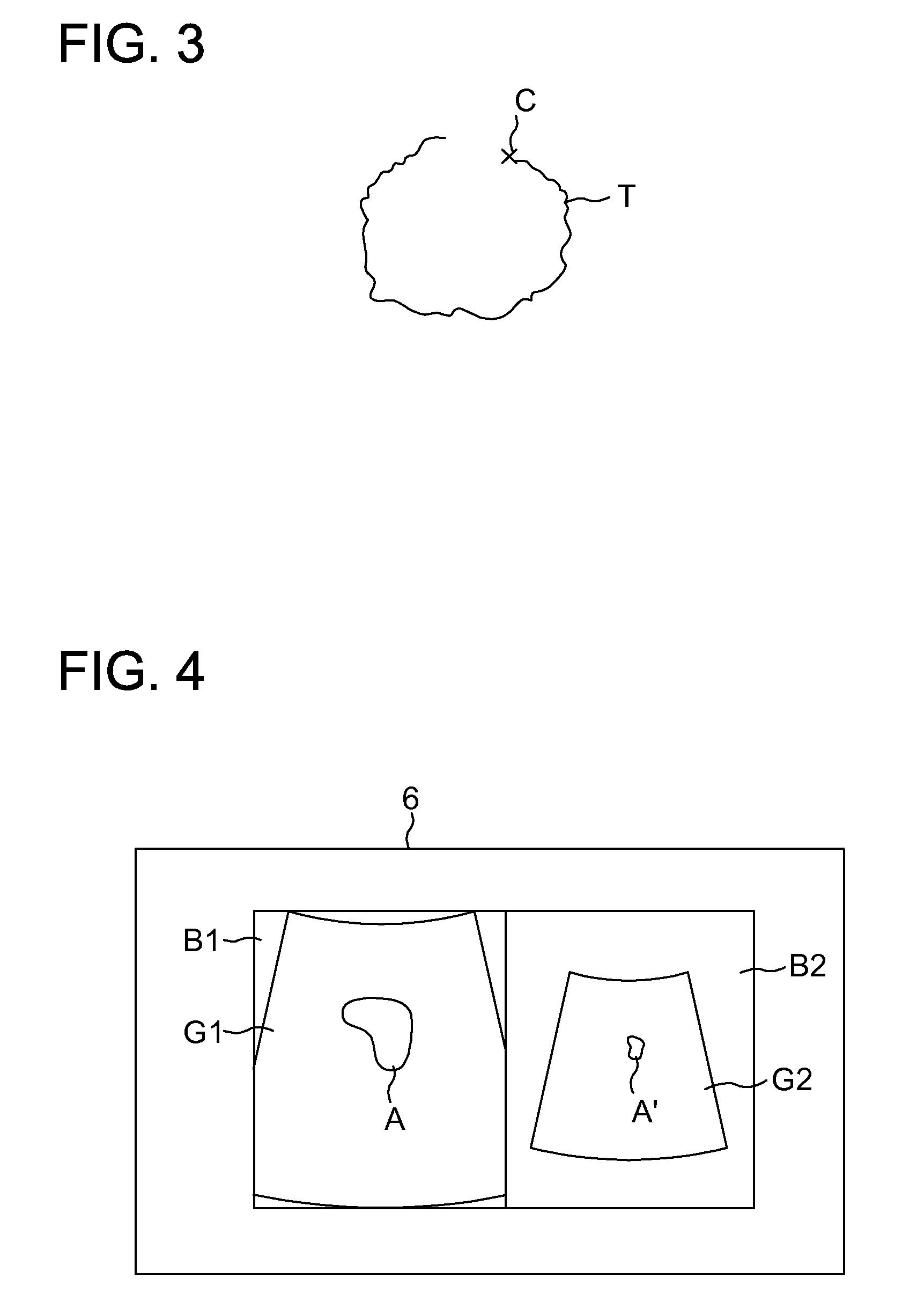 Diagnostic imaging apparatus and ultrasonic diagnostic apparatus