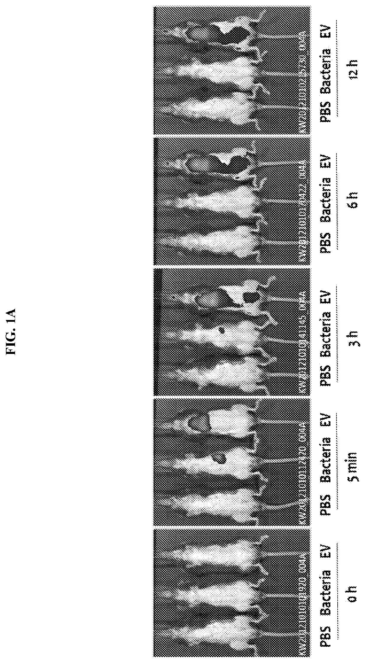 Nanovesicles derived from faecalibacterium prausnitzii and uses thereof