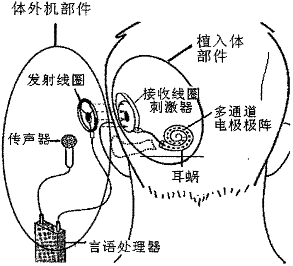 Electrical stimulation audition tone perception testing and estimating system