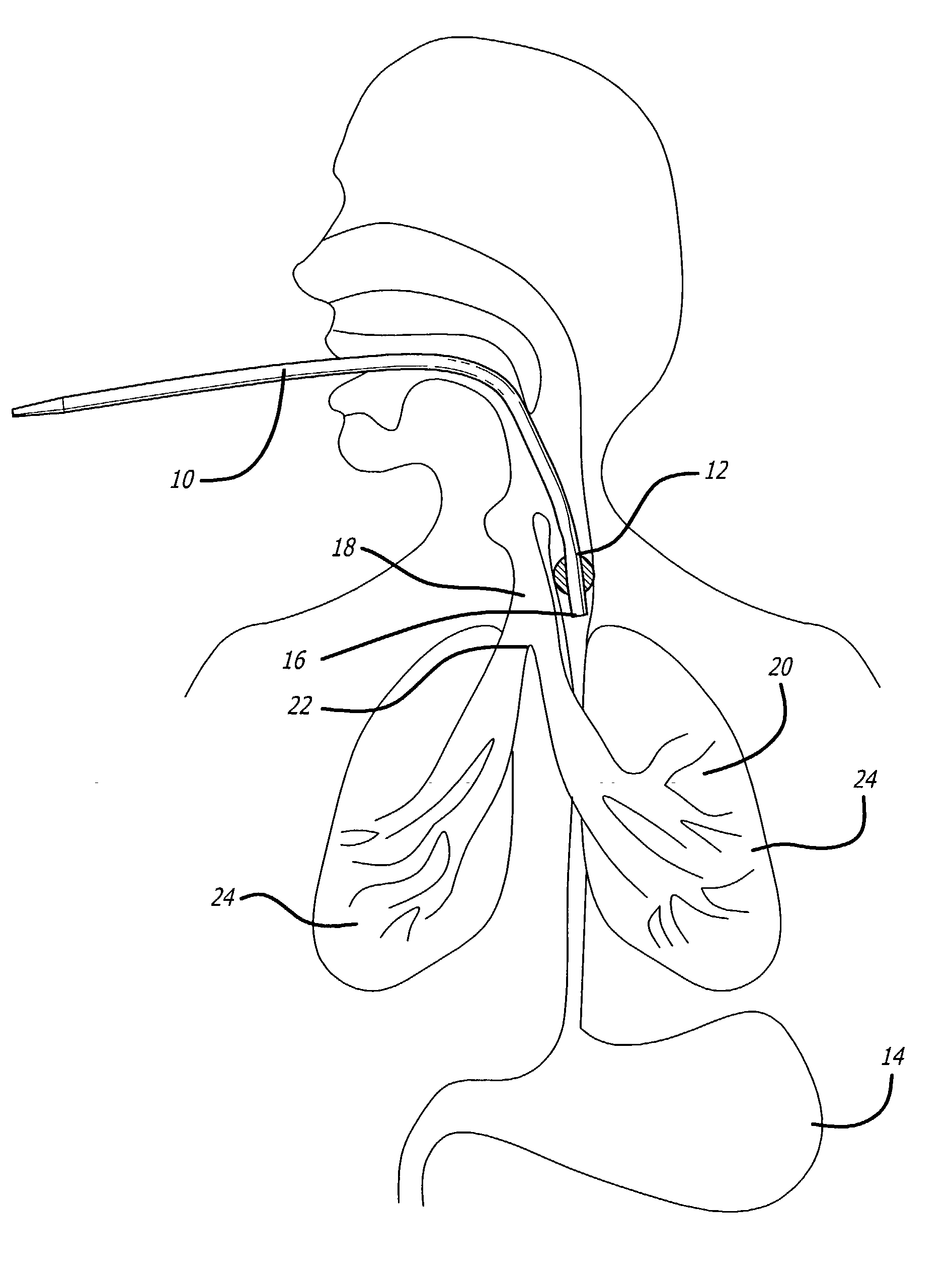 Determining endotracheal tube placement using acoustic reflectometry