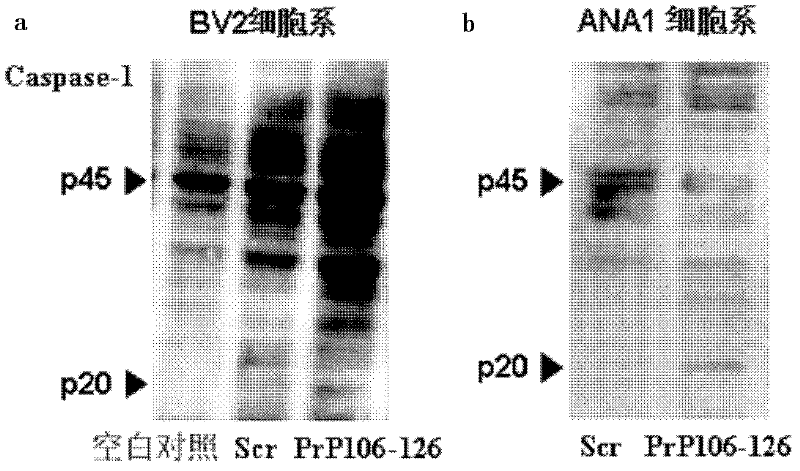 Application of NALP3-ASC inflammation complex and activator inhibitor thereof in terms of preparation of medicines for treating prion diseases