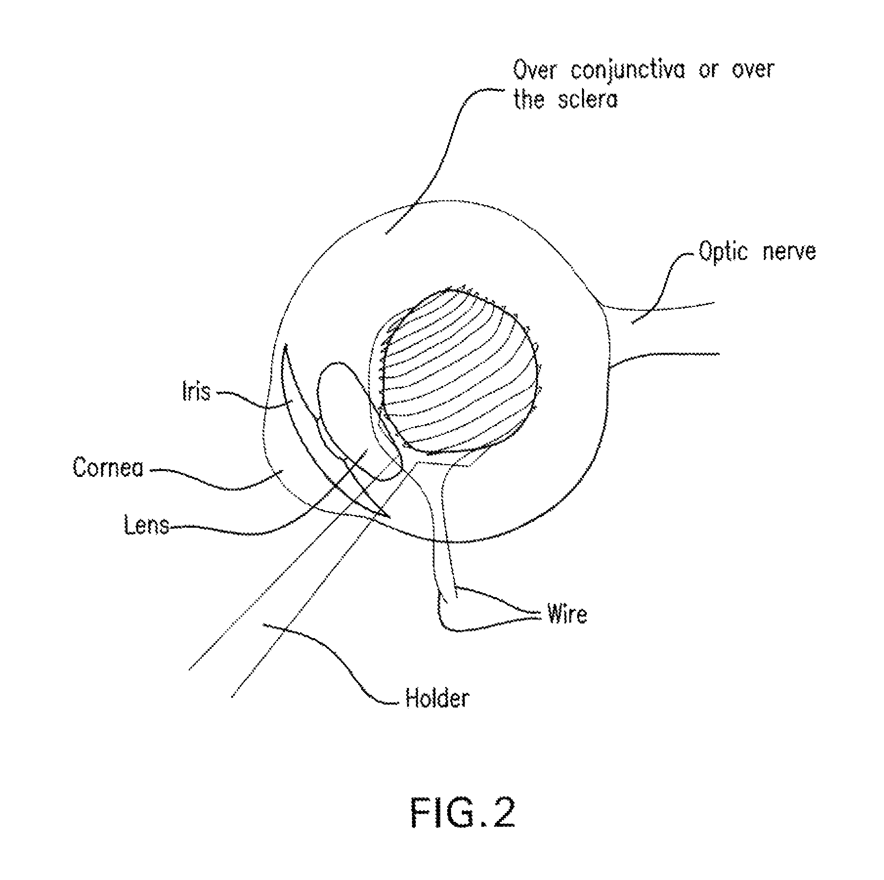 Method and composition for hyperthermally treating cells