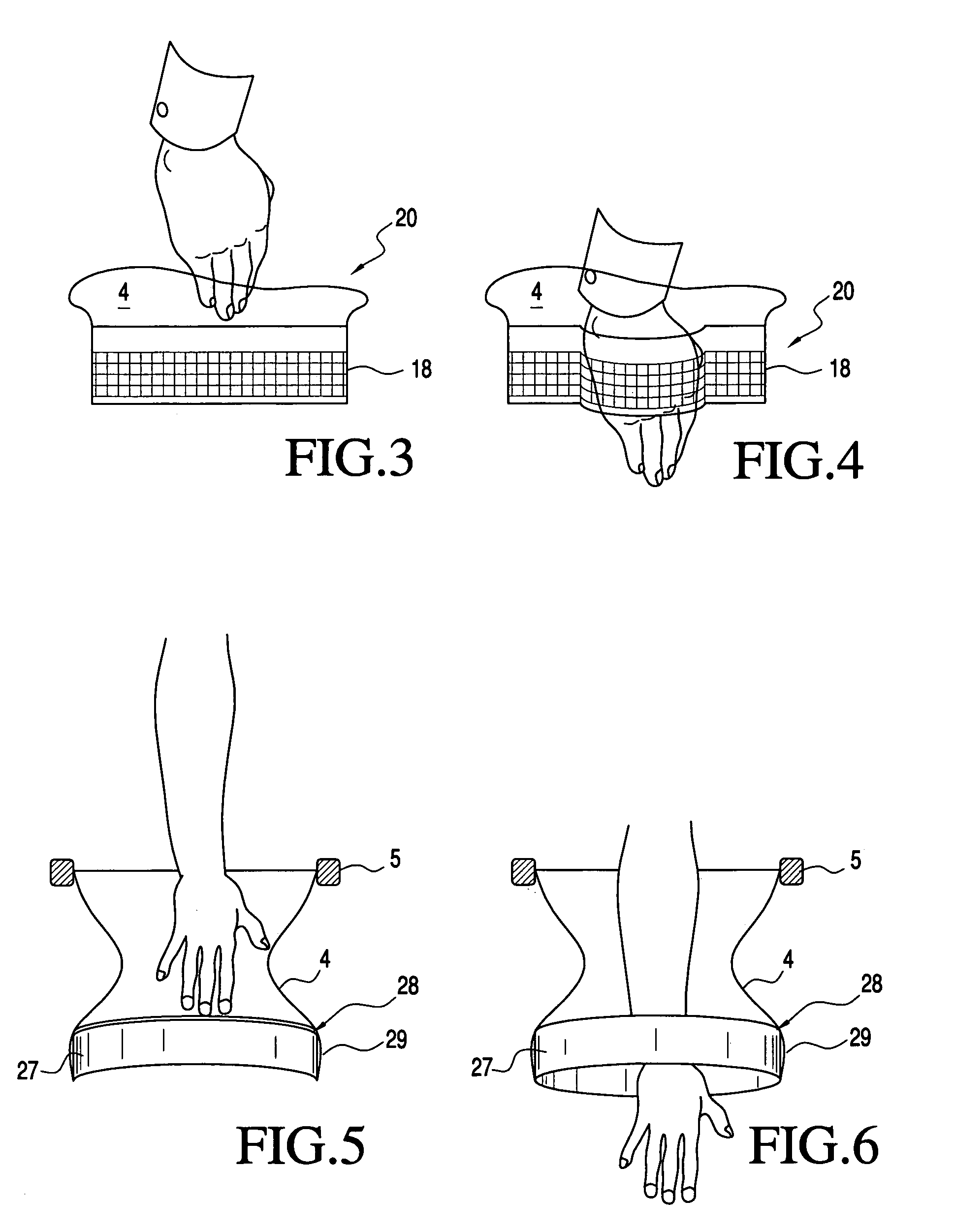 Surgical access device