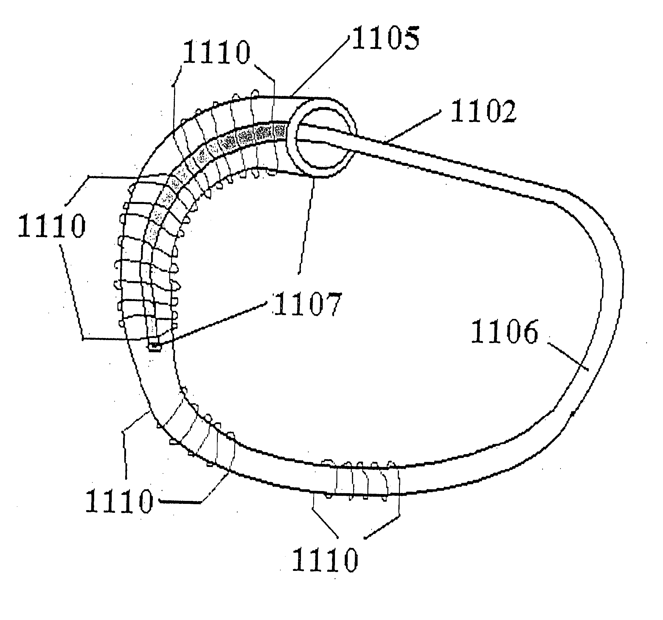 Micro-generator implant