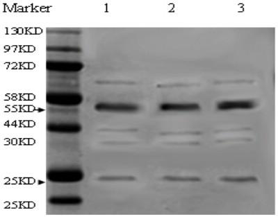 trpc3 antigen polypeptide and anti-trpc3 monoclonal antibody