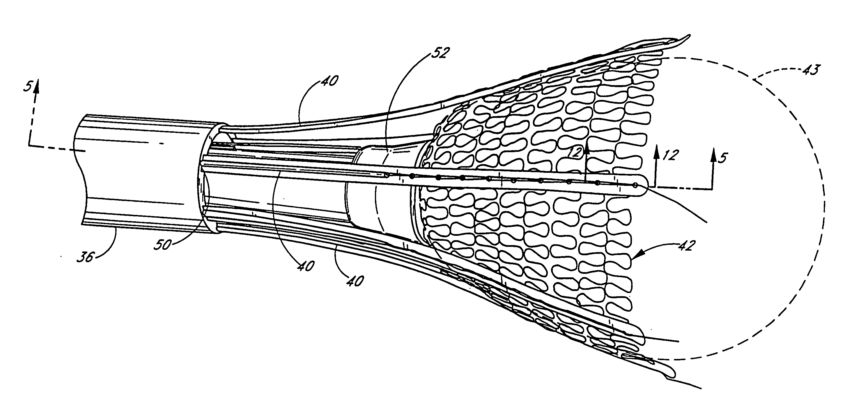 Cardiac harness delivery device and method of use