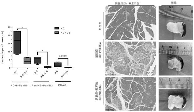 Application of cationic polymer in preparation of drugs for removing intestinal microbial toxins and treating tumors