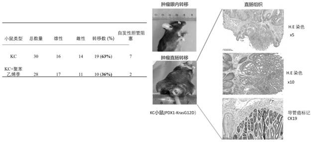 Application of cationic polymer in preparation of drugs for removing intestinal microbial toxins and treating tumors