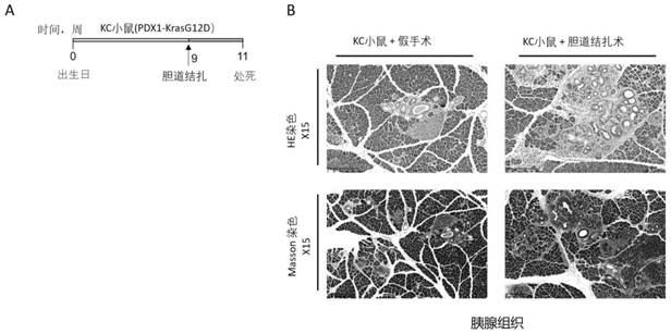 Application of cationic polymer in preparation of drugs for removing intestinal microbial toxins and treating tumors