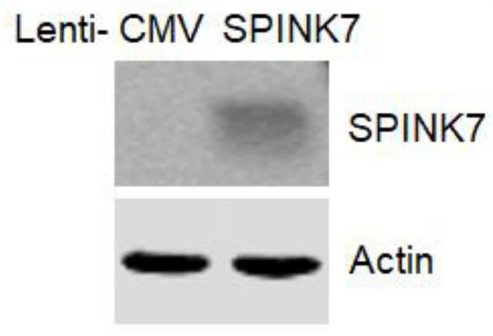 Application of protein SPINK7 in preparation of medicine for promoting healing of excessive-inflammation wounded area