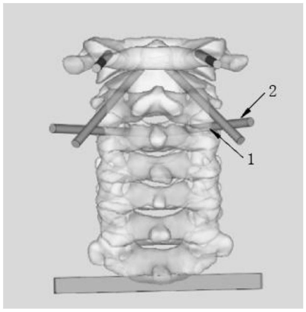 Augmented reality assisted spine internal fixation screw implantation method and system