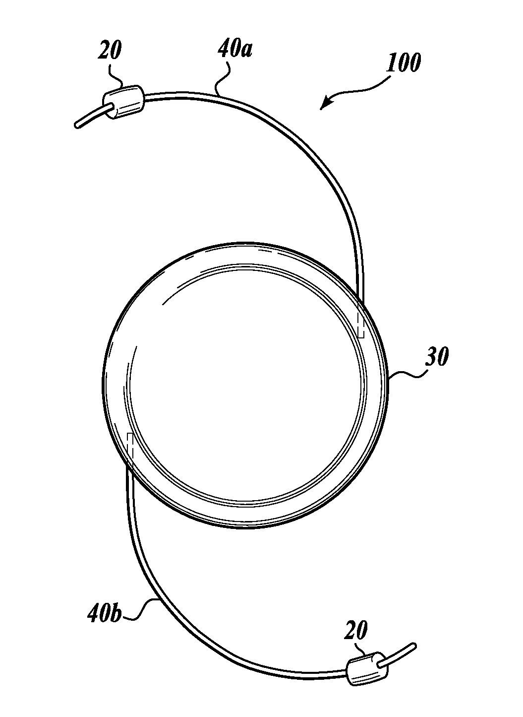 Device and method for intraocular drug delivery