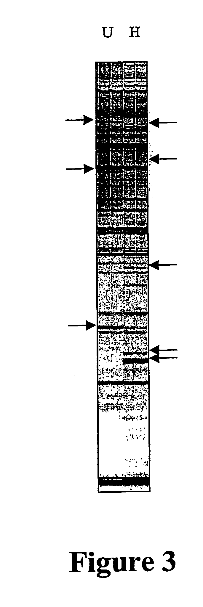 Detection of dna methylation