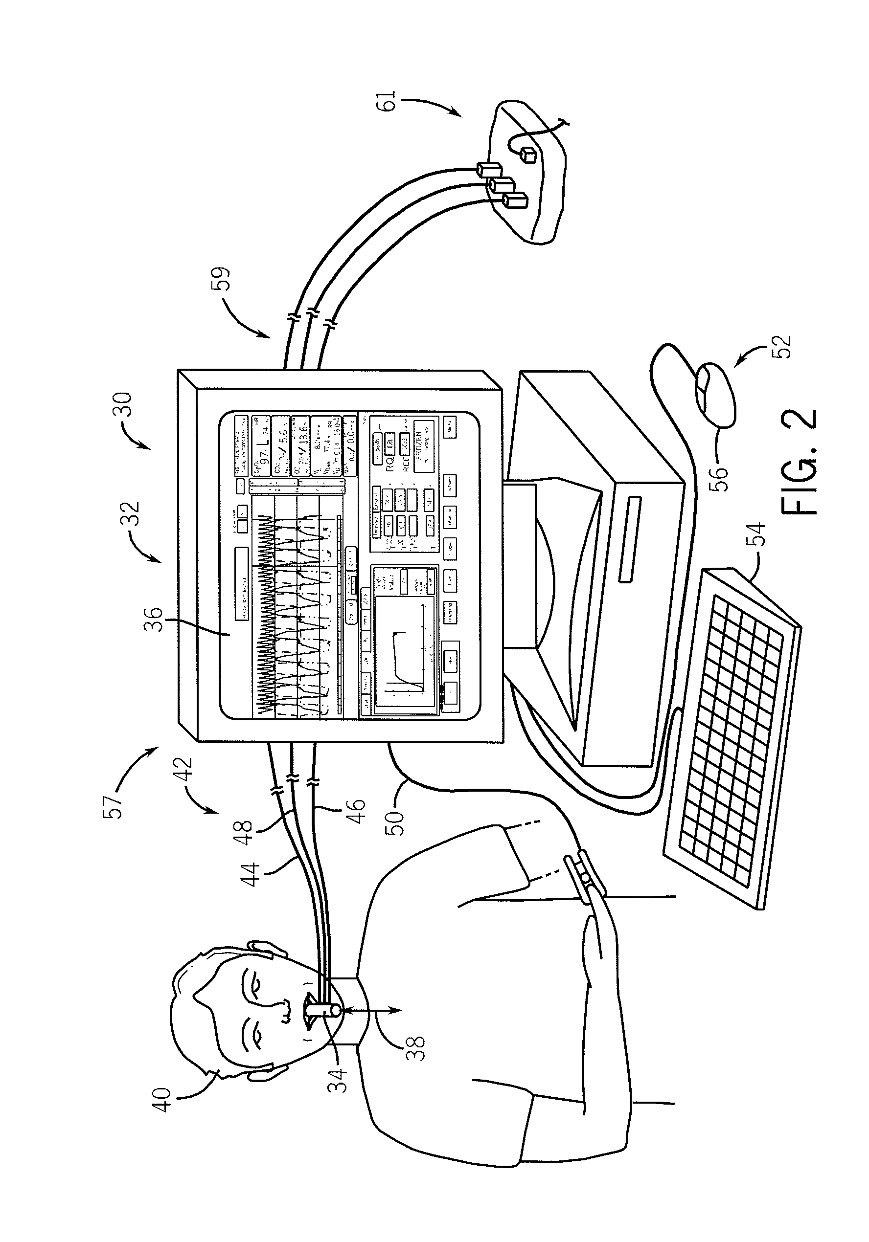 Side-stream respiratory gas monitoring system and method