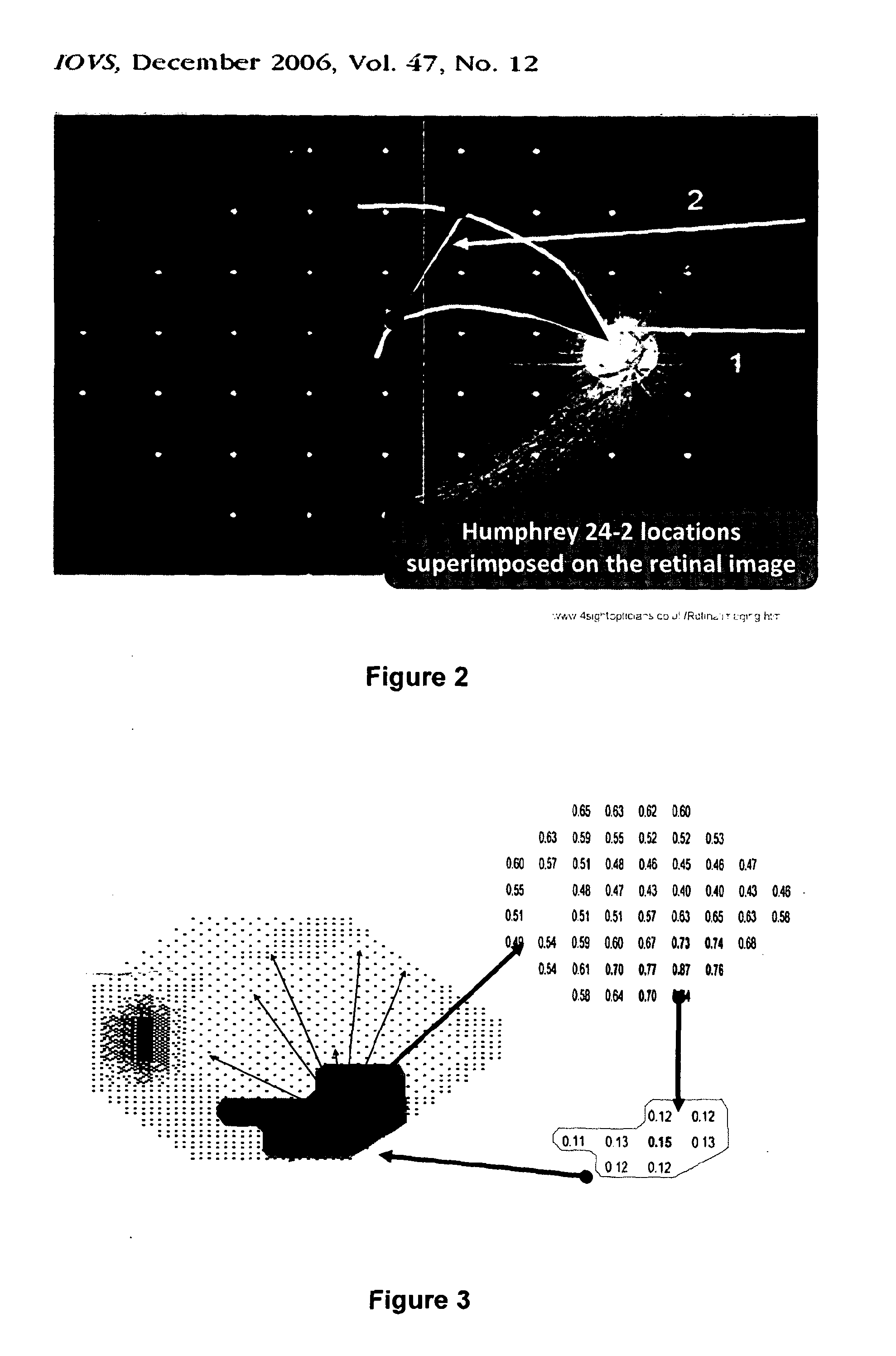 Supra-threshold test and a sub-pixel strategy for use in measurements across the field of vision